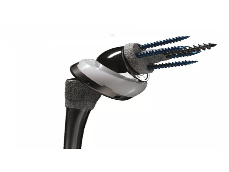 Sistema de Prótese de Ombro Comprehensive - Imagem 2